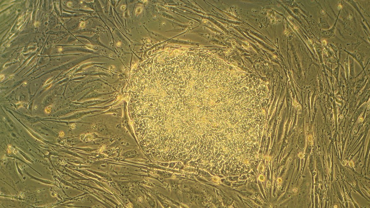 Cultured stem cells under the microscope — the living material at the centre of stem cell research and development; a Panacea Bio Chem programme dossier by Bogdan Dicoias